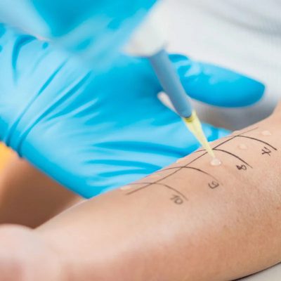 ALLERGOLOGIA