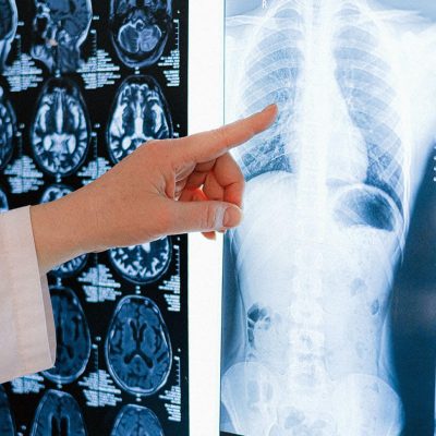 Radiologia