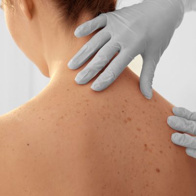dermatologia